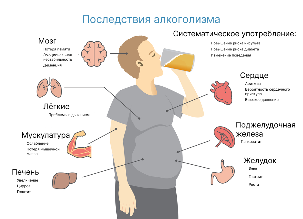 Курсовое лечение алкогольной зависимости